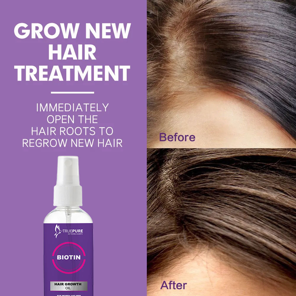 TruePure Biotin Hair Growth oil for all type hairs 90ml Essential Oil Anti Hair Loss Products Fast Growing Hair Scalp Treatment for Men Women