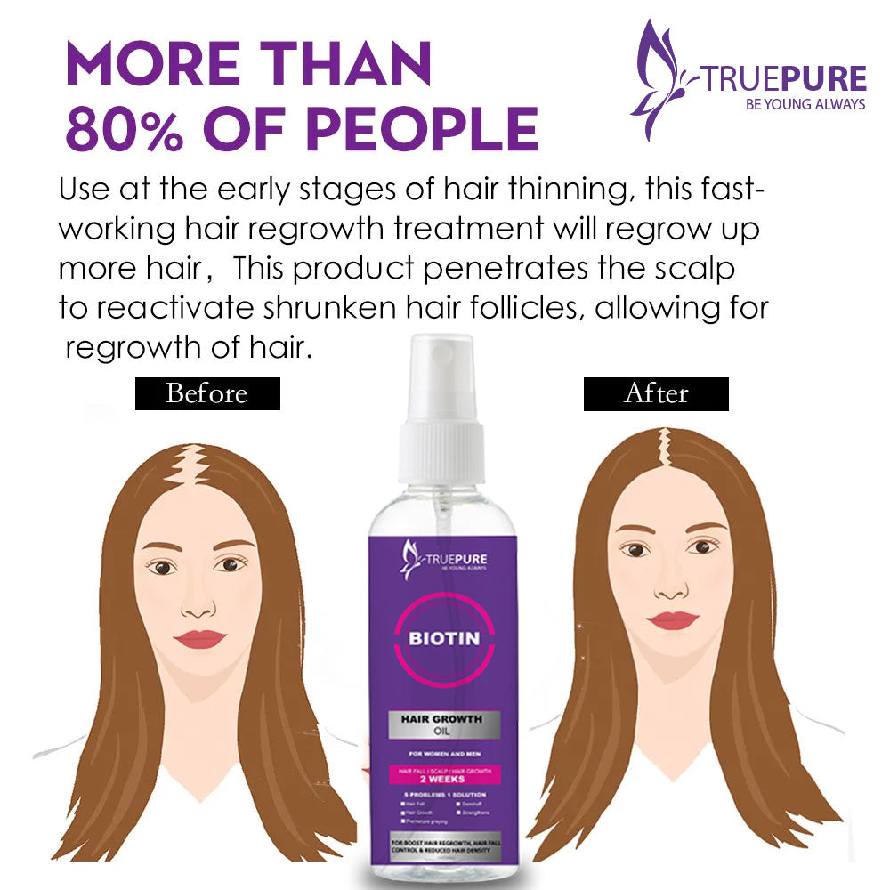 TruePure Biotin Hair Growth oil for all type hairs 90ml Essential Oil Anti Hair Loss Products Fast Growing Hair Scalp Treatment for Men Women