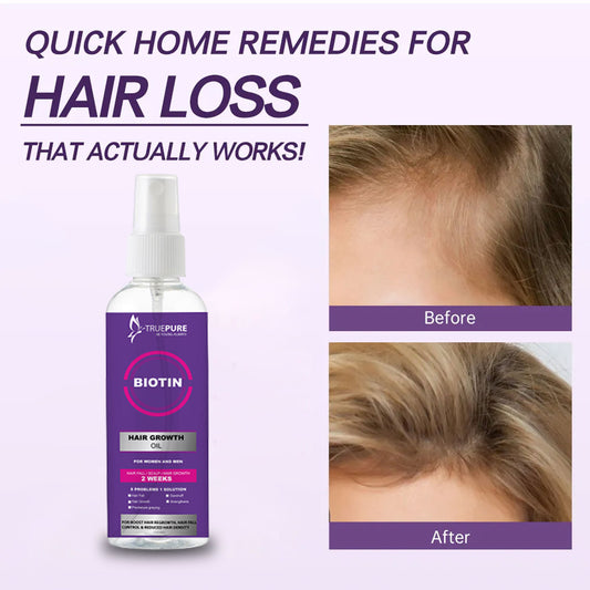 TruePure Biotin Hair Growth oil for all type hairs 90ml Essential Oil Anti Hair Loss Products Fast Growing Hair Scalp Treatment for Men Women