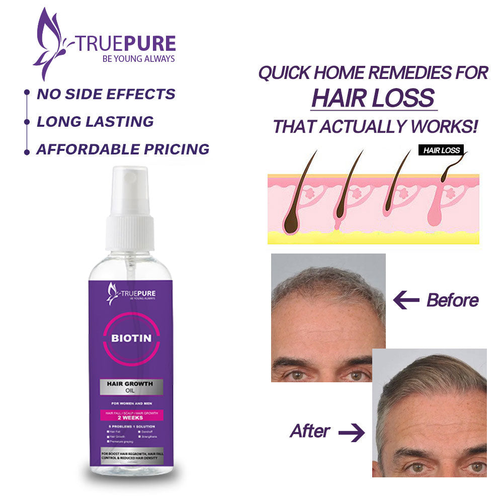 TruePure Biotin Hair Growth oil for all type hairs 90ml Essential Oil Anti Hair Loss Products Fast Growing Hair Scalp Treatment for Men Women