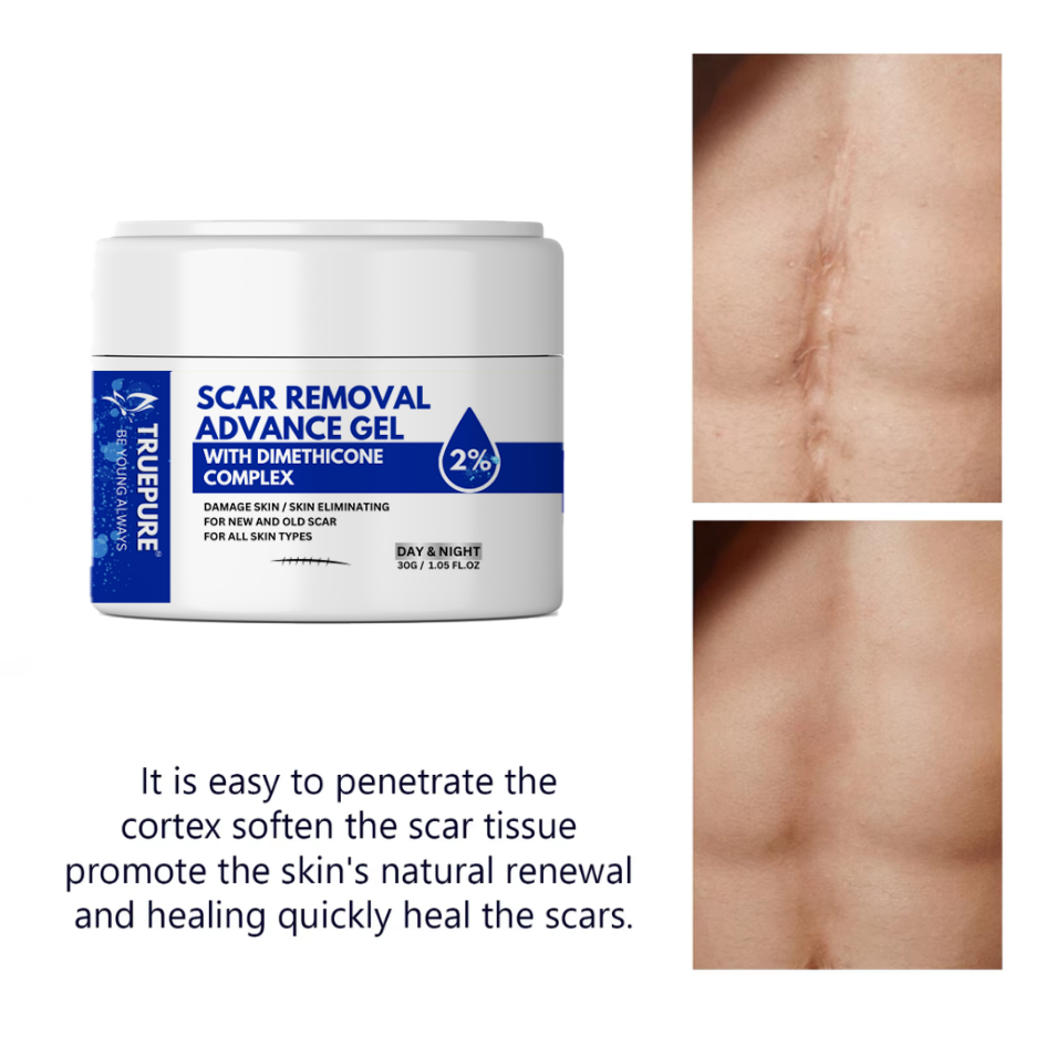 TruePure Advanced Scar Removal Gel Fade Acne Scars Stretch Marks Dark Spots for Clear Skin
