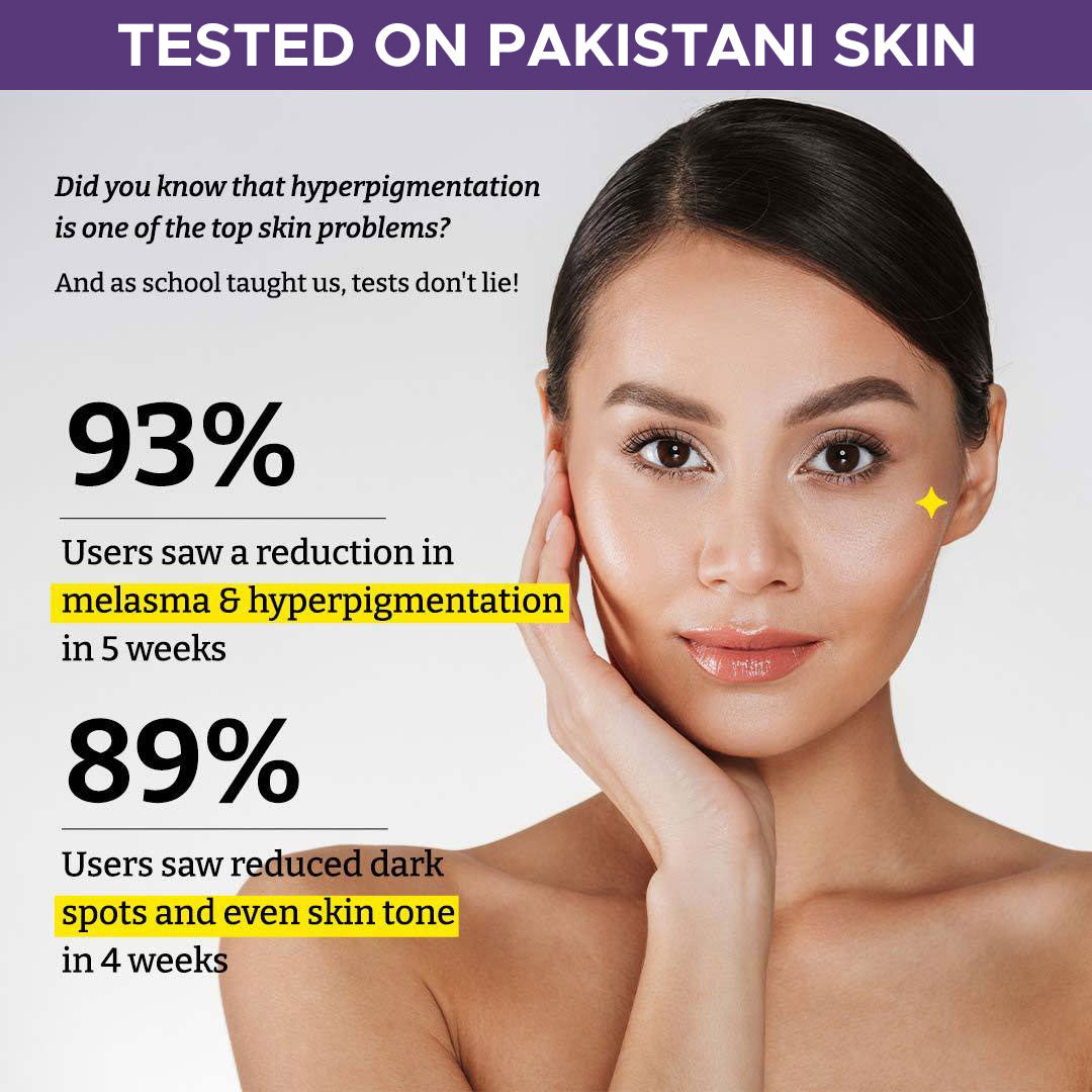 Truenex Pigment Correcting Serum | Face Serum for Melasma, Hyperpigmentation , Acne Spots | Acne Serum | Face Serum for Men and Women - 30ml